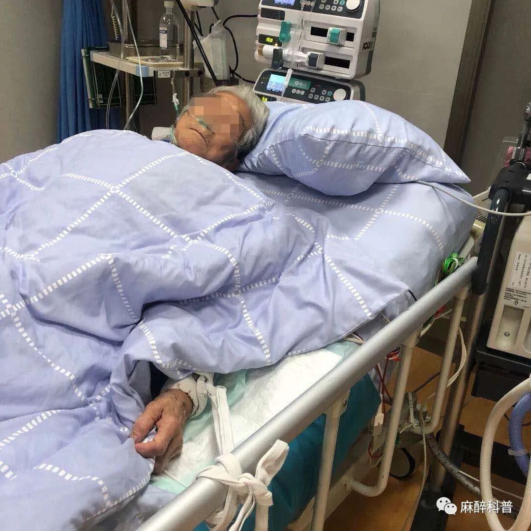 老人手动关400斤电动门被砸进ICU，一次意外的警示